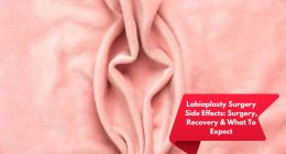 Labiaplasty Surgery Side Effects: Surgery, Recovery & What To Expect