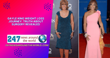 Gayle King Weight Loss Journey Truth About Surgery
