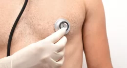 Can Gynecomastia Come Back After Surgery?