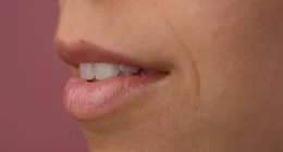 The Ultimate Guide to Preventing Dry Mouth After Rhinoplasty