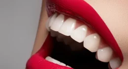 6 Different Methods for Teeth Whitening for 2024